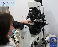 Slider image (5) In Vitro Fertility Clinic